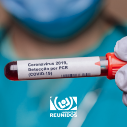 Coronavírus 2019, Detecção por PCR (COVID-19)